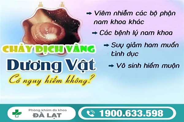 Hình ảnh minh họa